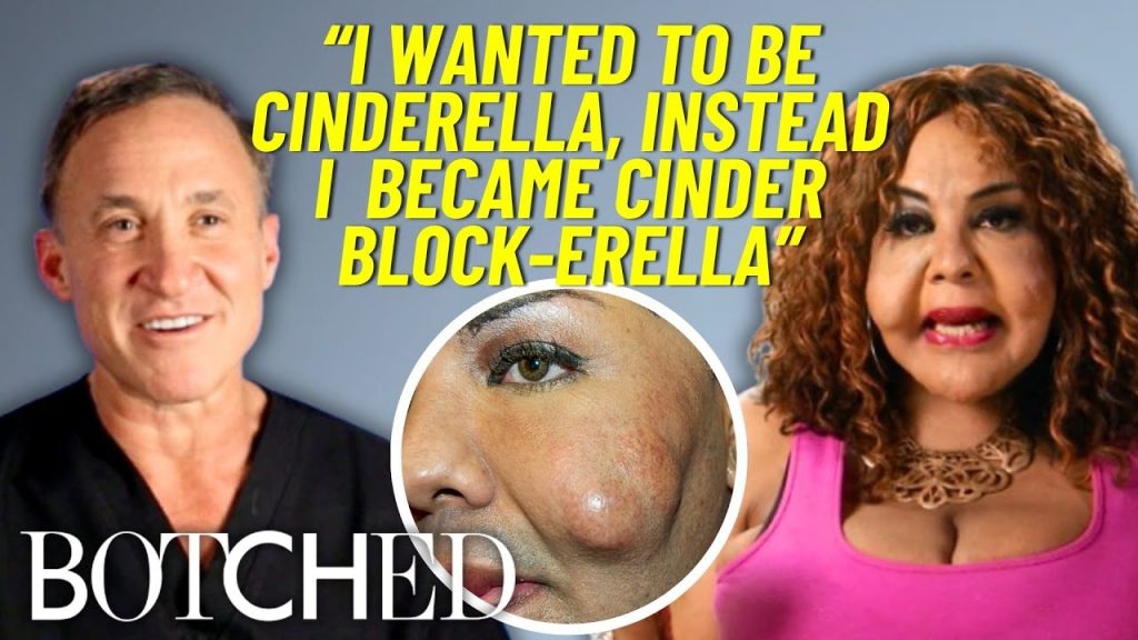 REJECTED by Botched: Rajee’s First Attempt At Removing Cement Filler ...